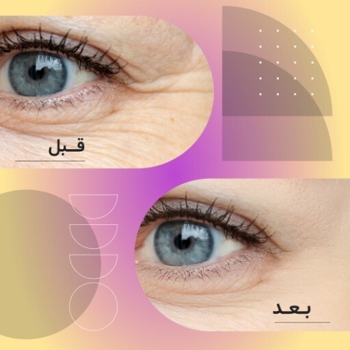 قبل و بعد
